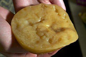 SCOBY - Wikipedia