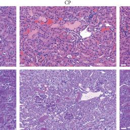 Effects Of Ac YVAD Cmk On Body Weight Renal Function And Renal