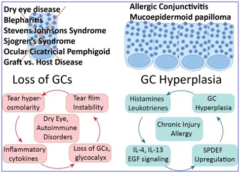 Conjunctival Goblet Cells Ocular Surface Functions Disorders That Affect Them And The