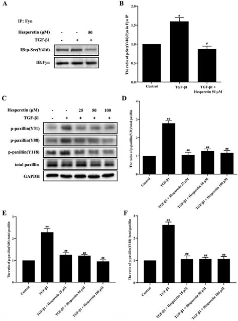 Hesperetin Inhibits TGF β1 Induced Migration and Invasion of Triple