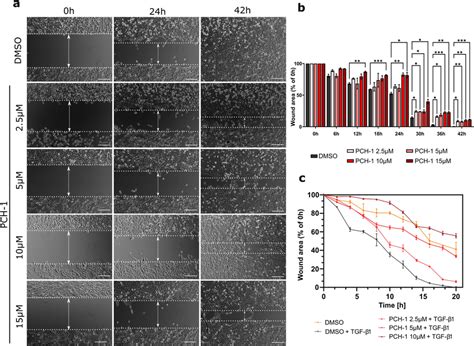 Analysis Of Cell Migration By In Vitro Wound Healing Assay A