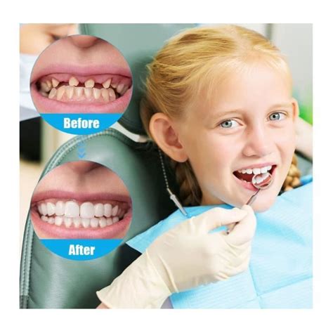 Paires Faux Dentier Sourire Parfait Dent Provisoire Fausse Dent