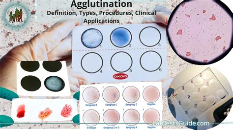 Agglutination Test Microbiology