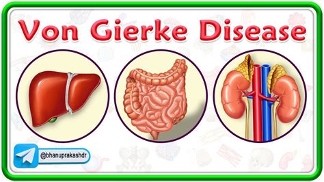 Von Gierke Disease Animation Glycogen Storage Disease Type I Gsd I