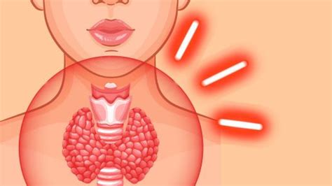 Ščitnica in svetlobna terapija fitobiostimulacija Klepet ob kavi