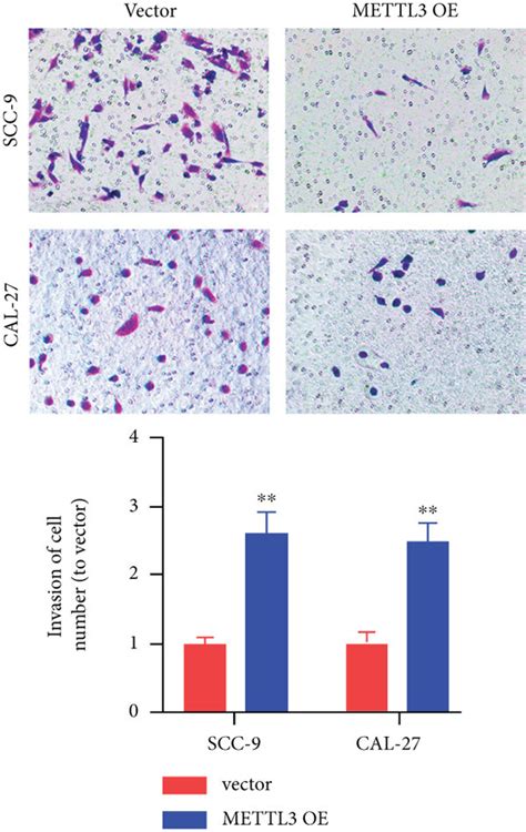 Mettl3 Intensified Oscc Cell Proliferation And Metastasis And