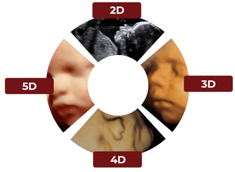 Quality And Affordable Ultrasound Scans In 2D 4D And HD