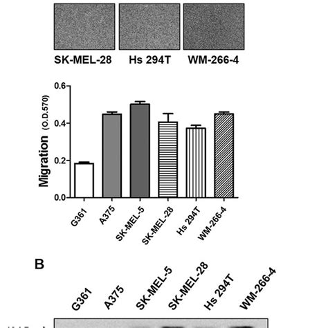 IL 32α expression is higher in migratory human melanoma cell lines A