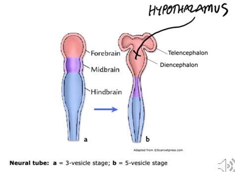 Hypothalamus + Appetite Control Flashcards | Quizlet