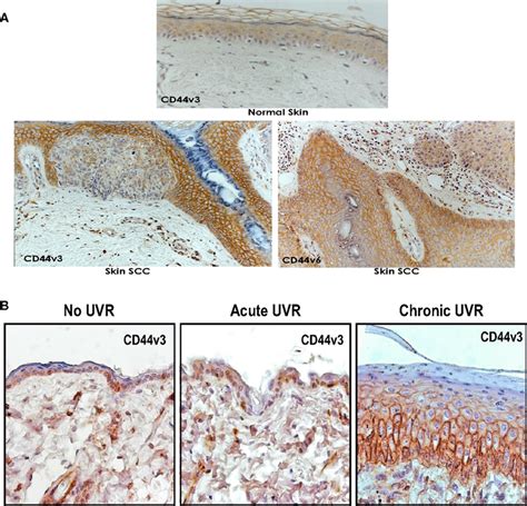 A Immunoperoxidase Staining Of Cd44v3 And Cd44v6 Isoforms In Normal