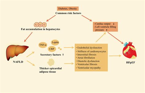 Frontiers Effects Of Treatment Of Non Alcoholic Fatty Liver Disease