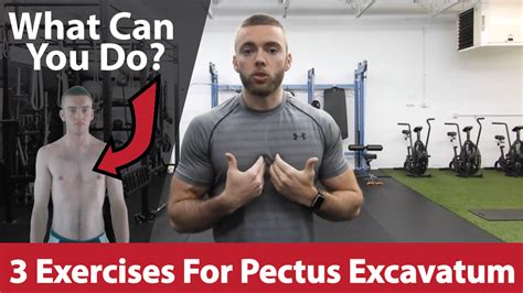 3 Exercises For Pectus Excavatum HypertroFit