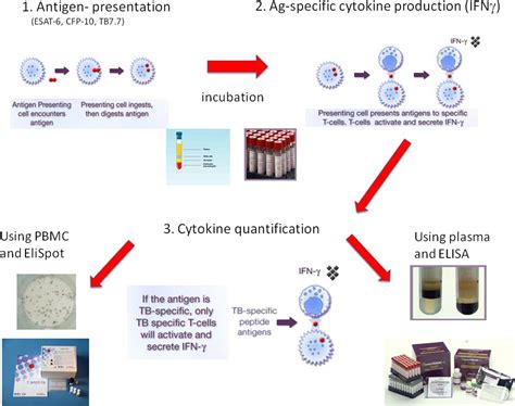 How To Use Interferon γ Release Assays For Tuberculosis Adc Education And Practice Edition