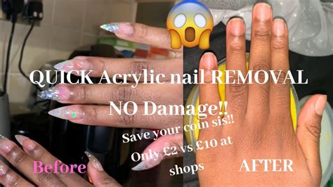 How To Remove Acrylic Nails Safely At Home Fast Youtube