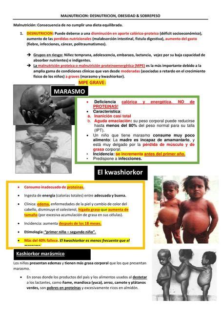 Desnutricion Kwashiorkor Y Marasmo Obesidad InaniciÓn Dra Eritro Udocz