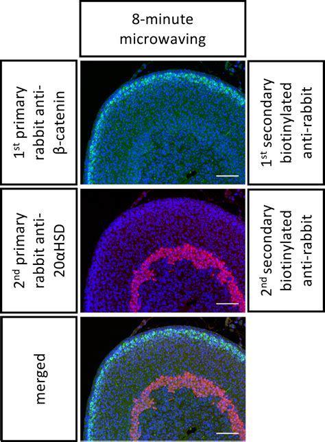 Microwaving And Fluorophore Tyramide For Multiplex Immunostaining On