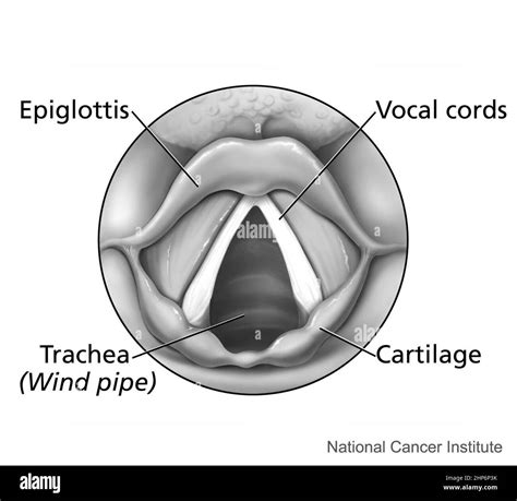 Glotis Y Epiglotis Fetal Cerdo