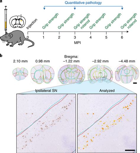 Quantitation Of Synuclein Pathology Allows For Brain Wide Analysis Of