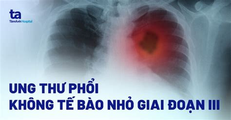 ung thu phoi la gi nguyen nhan va cach chan doan benh