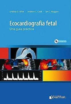 Libro Ecocardiograf A Fetal Una Gu A Pr Ctica De Lindsey D Allan