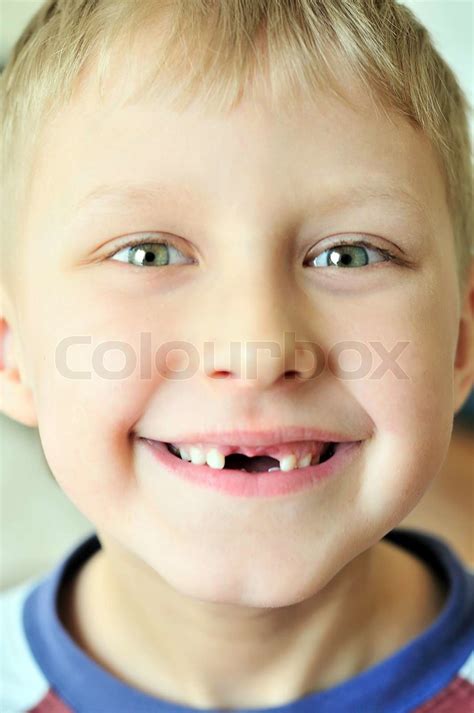 smile without tooth | Stock image | Colourbox