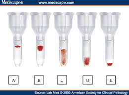 BLOOD BANK Flashcards Quizlet