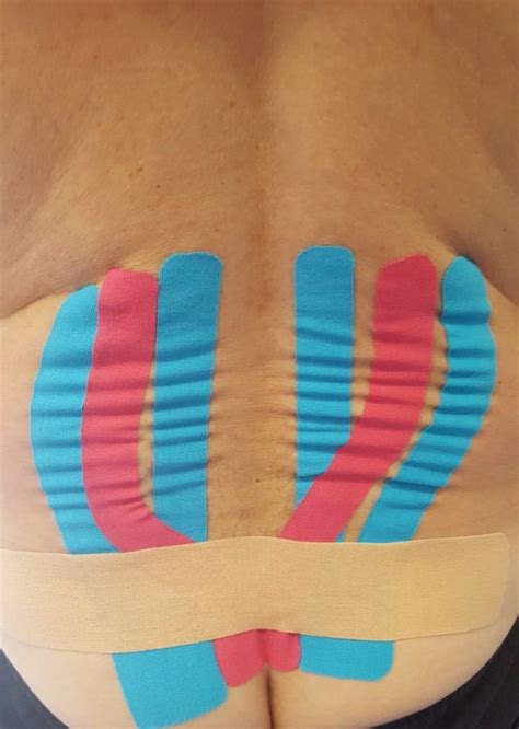 Curso De Vendaje Neuromuscular Kinesiotape De Columna Vertebral Nivel