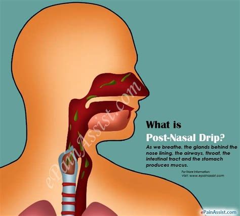 Understanding Post Nasal Drip