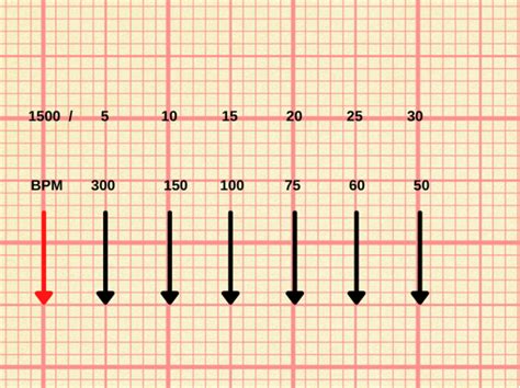 ECGNOW Telecardiologia