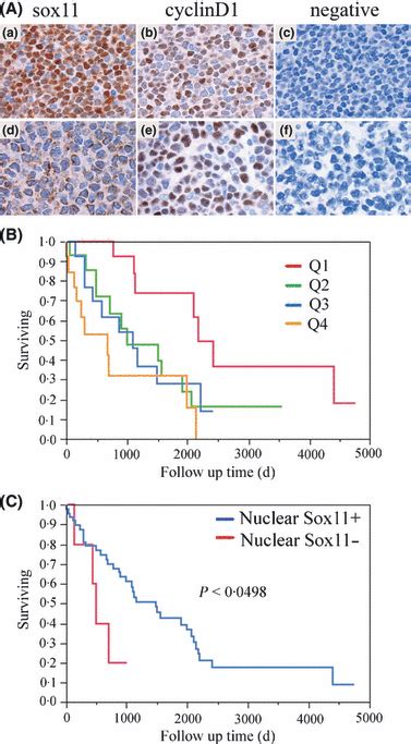 The Subcellular Sox11 Distribution Pattern Identifies Subsets Of Mantle