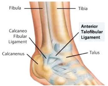 Ankle Ligament Reconstruction | Cal Sports & Orthopaedic Institute | Orthopaedic Specialists in ...