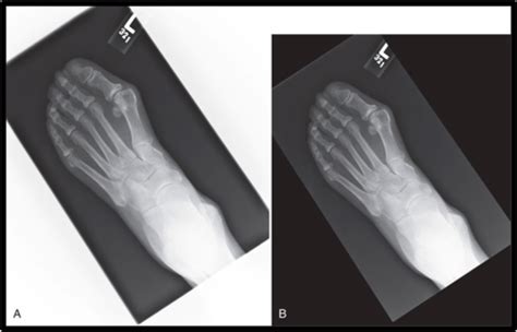 Imaging Equipment Operations Chapters Flashcards Quizlet