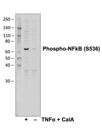 Phospho Nfkb P Ser B Rabbit Mab Abwiz Bio