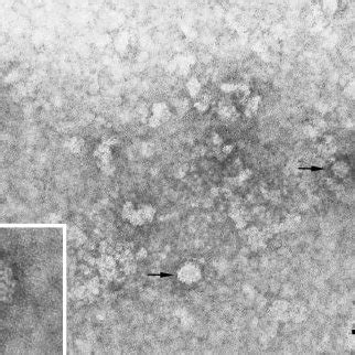 Transmission Electron Micrograph Of Negatively Stained Murine Norovirus