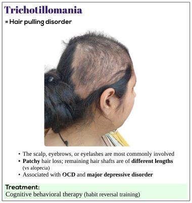 Trichotillomania Medicine Keys For MRCPs