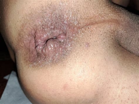 Prevention Of My Ass Nude Pics XHamster