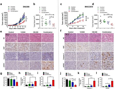 A Powerful Drug Combination Strategy Targeting Glutamine Addiction For