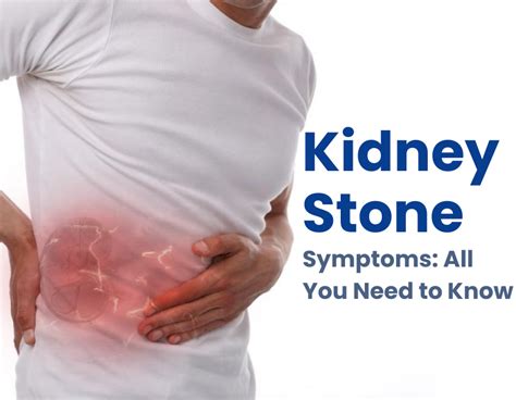 Kidney Stone Symptoms: All You Need to Know - Dr. Mulay Superspeciality ...