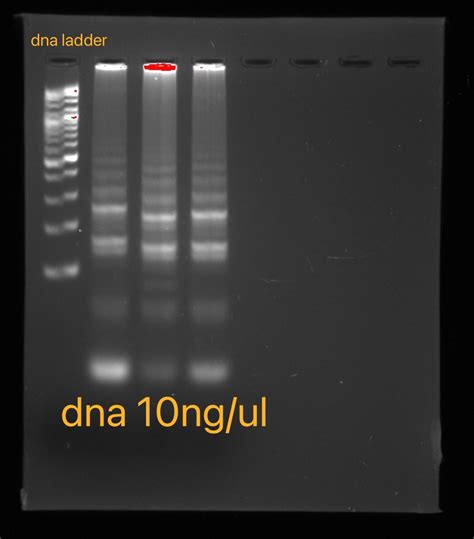 The Electrophoresis Results Best Support Which of the Following