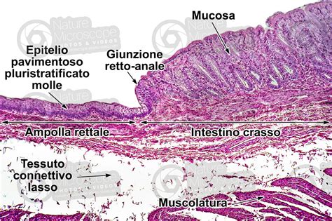 Mammifero Intestino Crasso Sezione Trasversale X Intestino