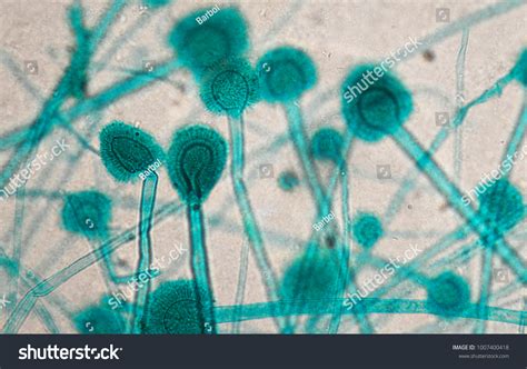 Aspergillus Under Microscope Stock Photo 1007400418 | Shutterstock