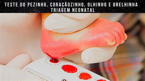 Teste do pezinho coraçãozinho olhinho e orelhinha Triagem neonatal