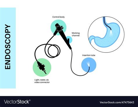 Gastroscopy Endoscopy Procedure Royalty Free Vector Image