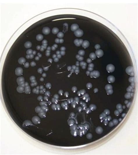 Representative Image Of Legionella Isolates Showing Growth On Gypc Agar Download Scientific