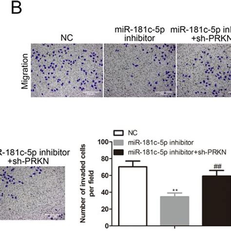 Mir 181c 5p Regulated Lung Adenocarcinoma Cell Proliferation