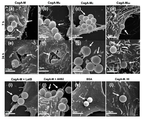 Toxins Free Full Text The Middle Fragment Of Helicobacter Pylori