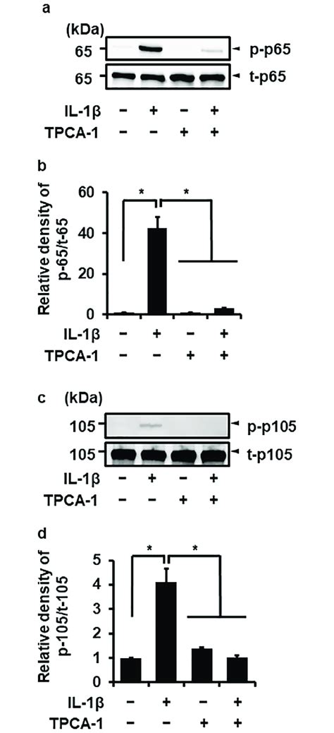 Effect Of The Nf κb Inhibitor On The Il 1β Induced Phosphorylation Of