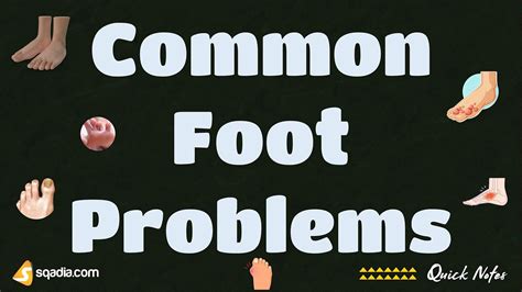 Common Foot Problems