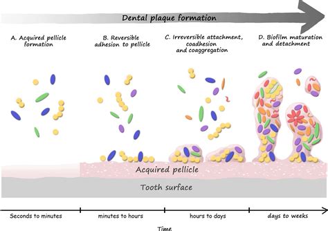 Dental Plaque Formation