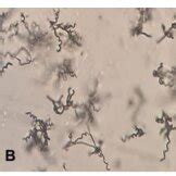 Spore chain morphology of Streptomyces (Light microscopy, 1000 x). A ...